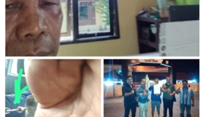 Terungkap! Oknum Keamanan PTPN IV Diduga Aniaya Jurnalis, Ucapkan Hukum Rimba