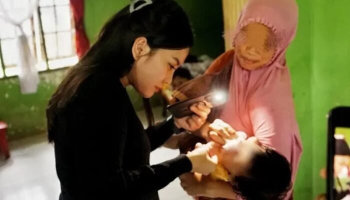 Sentuhan Wali Kota Medan Pulihkan Senyum Bayi Sumbing